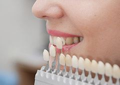 Cosmetic dentist holding shade guide to patient's smile