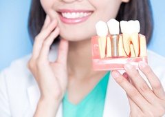 woman showing dental implant model