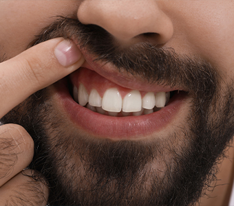 Close up of man pointing to his smile after cosmetic gum reshaping in Waverly