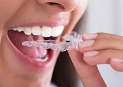 Close up of woman putting Invisalign tray in mouth