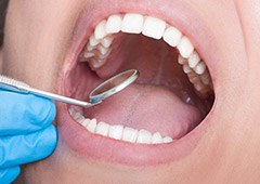 Close up of mouth open wide during dental checkup