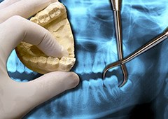 Tooth extraction tool in front of dental x ray