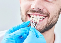 A male patient having a shade guide used to compare the color for veneers