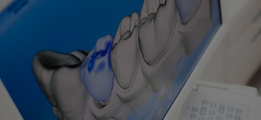 Close up of screen showing digital impressions of teeth