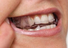 Close up of person pointing to oral appliance over their teeth