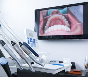 Close up of inside of mouth on screen in dental office