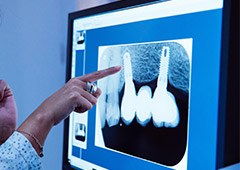 Dentist pointing to screen showing digital dental x rays