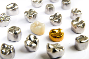 Various dental crowns