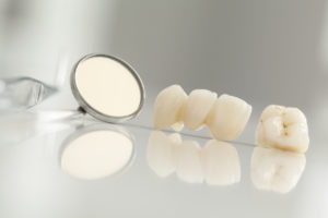 CEREC crowns in Waverly are made chairside.